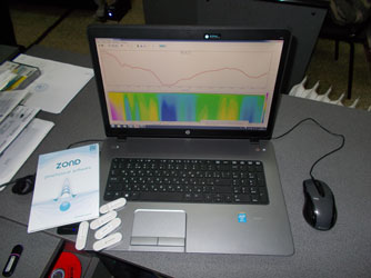 ����������� ����������� Zond